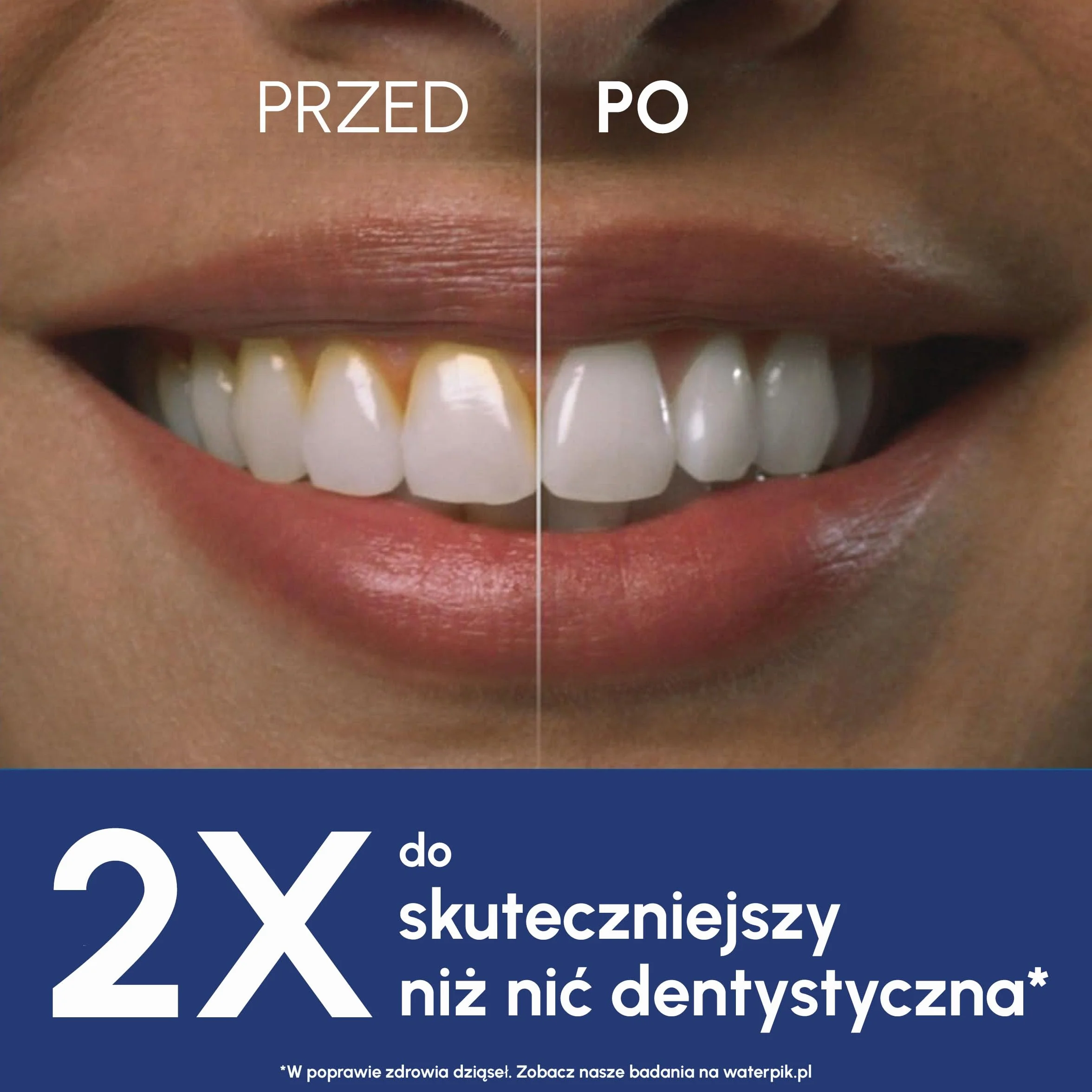 Waterpik Irygator Ultra Professional, 6 Końcówek, Zaawansowana Kontrola Ciśnienia z 10 Trybami, Skuteczne Usuwanie Płytki Nazębnej, Kolor Biały, 650 ml (WP-660EU)