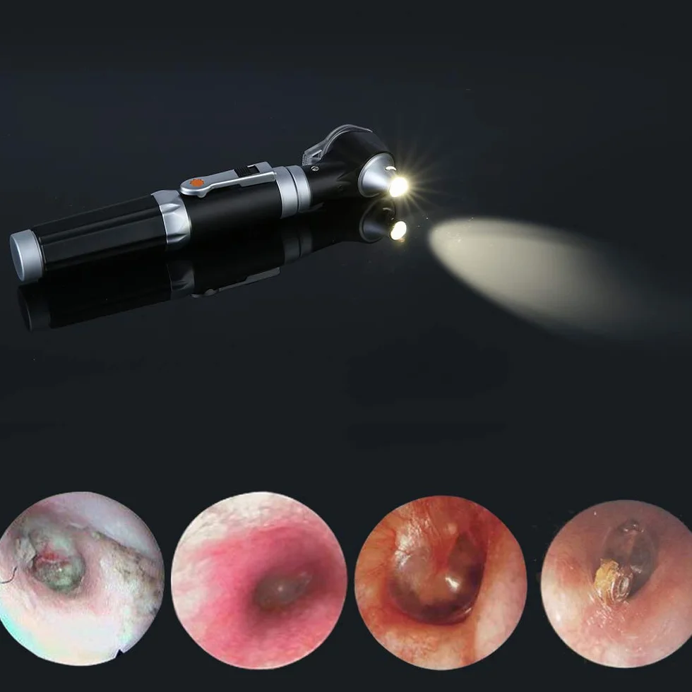 Mini otoskop, otoskop diagnostyczny z powiększeniem z bezpośrednim oświetleniem LED, zdrowe ucho narzędzie dla lekarzy pielęgniarki dorośli dzieci dziecko starsze zwierzęta domowe zwierzęta