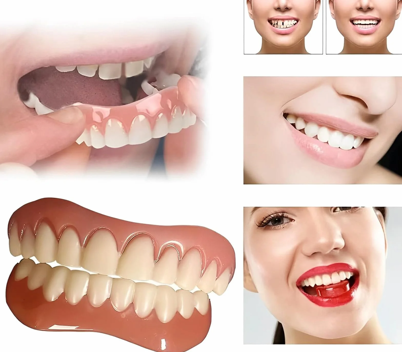 Snap on Perfect Smile Sztuczne Zęby 1 Pary Zatrzaskowe Silikonowe Forniry, Tymczasowe Wybielanie Proteza Okładka Górne I Dolne, Licówki Natychmiastowe Protezy Dla Mężczyzn I Kobiet Dorosły